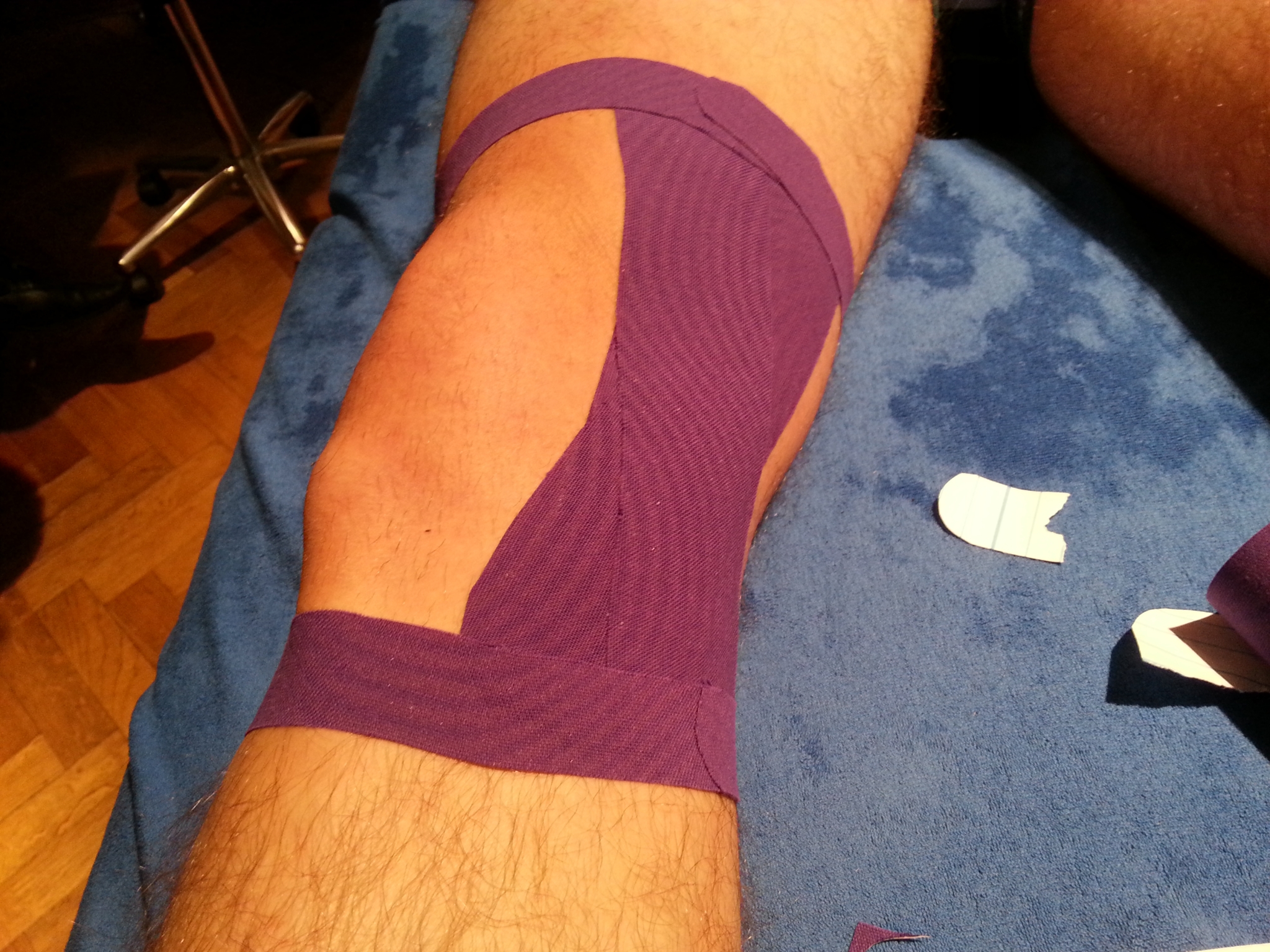 Medical taping Arnhem Noord Fysiotherapie